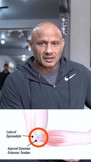 218K views · 2.7K reactions | How to prevent elbow joint pain or tennis elbow pain & minor remedies if you already have elbow pain. Watch, listen & learn through full video Brand ambassador @myproteinin Link in bio Code-MUKESH #dronacharyathegym #elbowpain #jointpain #jointpainrelief #tenniselbow #relief #prevention #skullcrushers #coldtherapy #icing #mukeshgahlot | Mukesh Singh Gahlot | Facebook