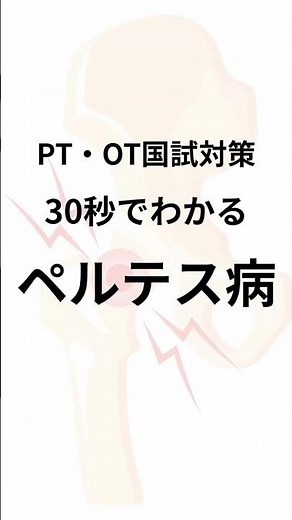 30秒でわかるペルテス病 #shorts #理学療法士 #作業療法士 #国家試験対策