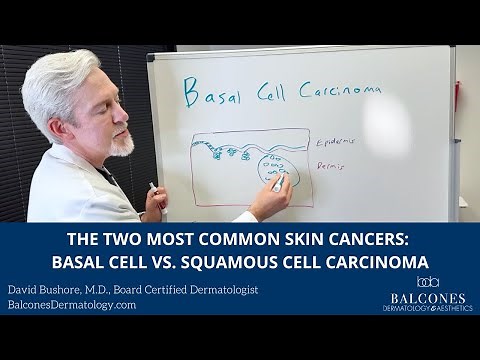 The Two Most Common Skin Cancers: Basal Cell vs. Squamous Cell Carcinoma with Dr. David Bushore