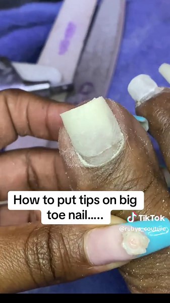 How to put tips on big toe nail #bestnailsforgirls #kawangwarenailspa #toenail #fypシ゚ #fyppppppppppppppppppppppp