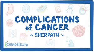 Complications of Cancer: Video, Causes, & Meaning | Osmosis