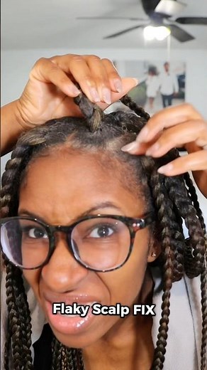 Fix Your Flaky Scalp FAST | Braid Series Pt. 3 #dandruff #haircare #braids