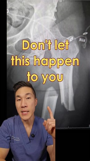 Jeff Yoo, MD | Emergency Physician on Instagram: "2026 is the year to get strong 🏋️ #medical #doctor #gains #strength #fitness"