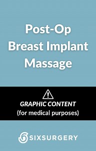 Breast Implant Massage