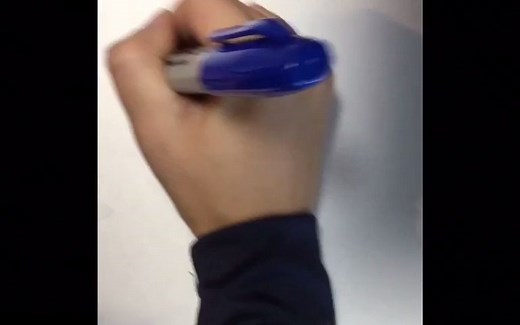 Modified Ashworth Scale / 改良Ashworth分级评估