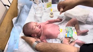 Newborn Baby Delay Cry After Resuscitation _ IV Line Insertion Step by Step in NICU Care 💉 #nicucare #baby #babycare #fbyシvideo #babycaretips #newbornbaby A newborn baby presented with a delayed cry after birth, requiring resuscitation and NICU observation. 🩺 After immediate resuscitation, the baby responded with a good cry and improved oxygen levels. 🙏 👩‍⚕️ The nurse then performed IV line insertion step-by-step for medication and fluid support under Gautam Ashish supervision. 💖 The baby’s