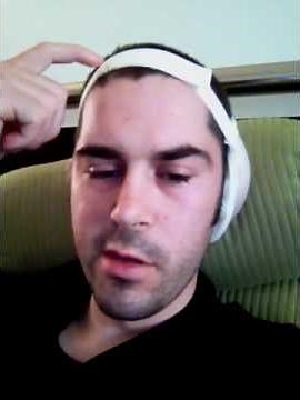 Mastoidectomy Surgery