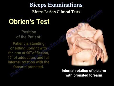 Biceps tendon Injuries, Examinations & Tests - Everything You Need To Know - Dr. Nabil Ebraheim
