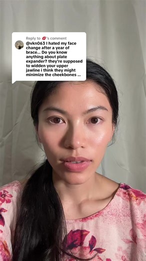 Understanding Palatal Expanders for Adult Braces