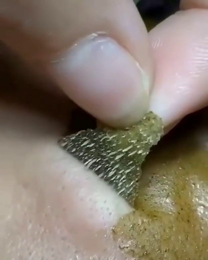 Peeling this green tea face mask.