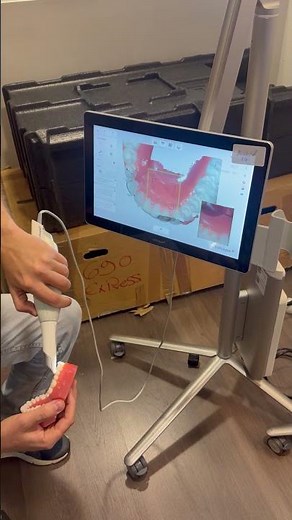 Scan full video 3Shape TRIOS MOVE+ with 3Shape TRIOS 3 Intraoral Scanner #intraoralscanner #3shape