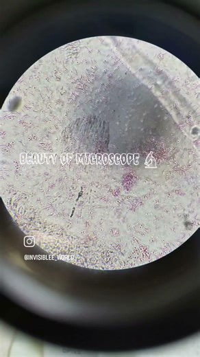 microscopy 🔬 #microbiologylab #microorganisms #invisibleworld