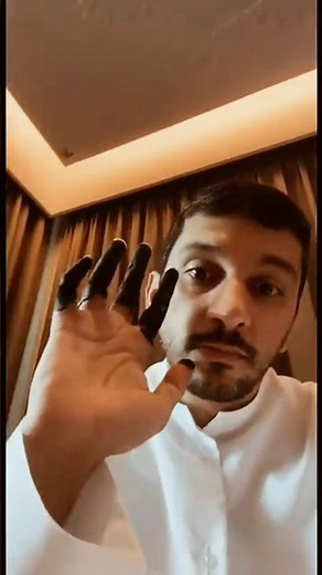 frostbite injury | finger dry gangrene