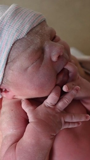 32K views · 504 reactions | The white coating on your baby's skin...