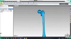 骨科geomagic精确曲面（一）