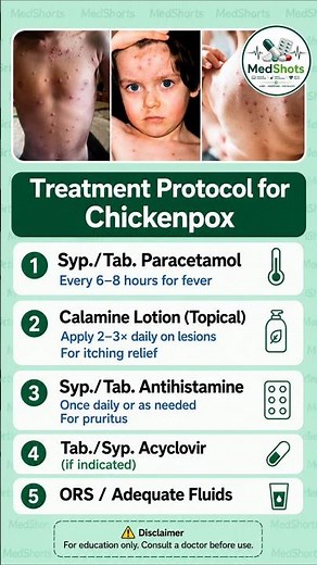 Chickenpox Treatment Protocol Explained Quickly 🤒💊