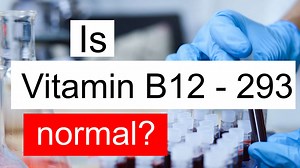 Is Vitamin B12 293 normal, high or low? What does Vitamin B12 level 293 mean?