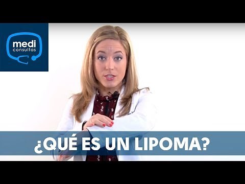 Lipoma: What is it? #MedicalConsultations