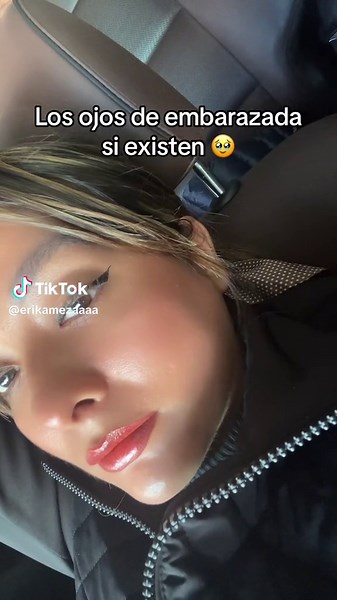 Identificando los Ojos Brillosos en el Embarazo