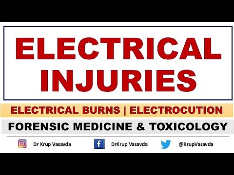 Electrical Burn | Electrical Injuries | Forensic Medicine | Dr Krup Vasavda
