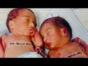 Caring for Newborn Twins During Feeding | Gentle Twin Baby Care 💖👶👶🍼#newborncare #twinsbaby