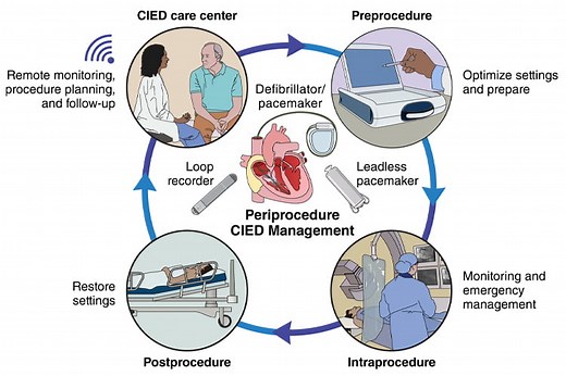 Periprocedural Management and Multidisciplinary Care Pathways for Patients With Cardiac Implantable Electronic Devices