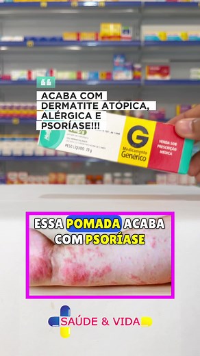Mometasona: Pomada para Dermatite Atópica e Psoríase | Saúde e Vida