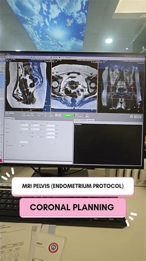 MRI PELVIS CORONAL PLANNING (ENDOMETRIUM PROTOCOL)#trandingsong #youtubeshorts #uterus #viralvideo