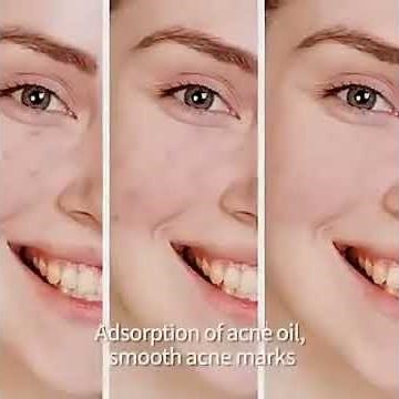 BioAQUA Pure Skin Cream | Remove Acne, Pimples & Dark Spots Naturally ✨