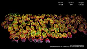 3K views · 92 reactions | Long-term volumetric imaging meets subcellular resolution. Join us on December 1: https://zeiss.ly/fb-lattice-lightsheet Human induced pluripotent stem cells. Image generated using AICS-0013 (laminB1-mEGFP) from the Allen Institute for Cell Science, Seattle, USA. #zeiss #latticelightsheet #llsm #lls #microscopy | ZEISS Microscopy | Facebook