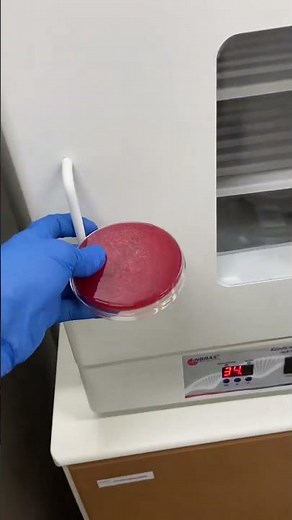 Pseudomonas aeruginosa: A Bactéria que 'Derrete' o Ágar Sangue 💚