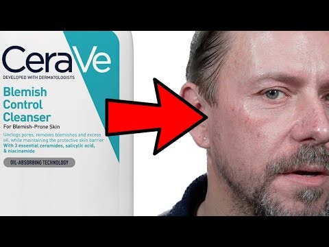 CeraVe DID THIS TO MY SKIN!