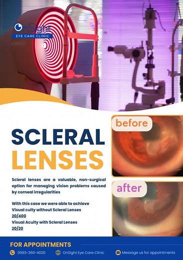 OnSight Eye Care Clinic on TikTok