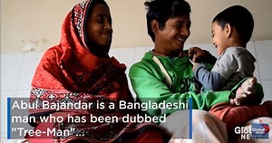 After Dozens of Surgeries, 'Tree Man's' Prospects Bleak