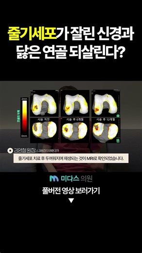 줄기세포가 기적이라 불리는 4가지 이유