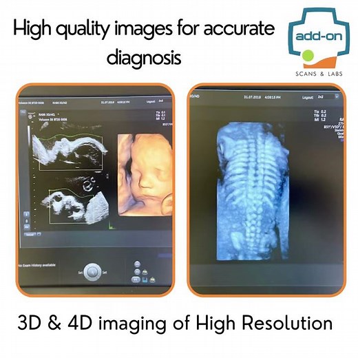Introducing the most advanced Ultrasound scan machine - add on Scans & Labs | GE VOLUSON E6 BT 20