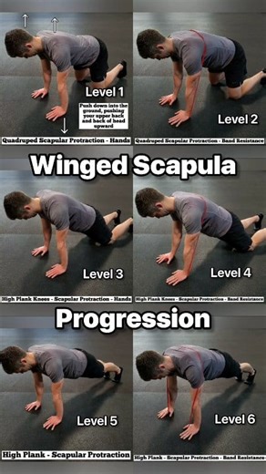 ✅ Comment "𝗡𝗘𝗖𝗞 𝗙𝗜𝗫" to get my 𝗡𝗘𝗖𝗞 & 𝗦𝗛𝗢𝗨𝗟𝗗𝗘𝗥 𝗕𝗟𝗔𝗗𝗘 𝗥𝗘𝗖𝗢𝗩𝗘𝗥𝗬 program in my app for your first 𝟳 𝗗𝗔𝗬𝗦 𝗙𝗥𝗘𝗘 💯 In addition to this program, you’ll also have access to 𝟭𝟬 𝗳𝘂𝗹𝗹 𝗹𝗲𝗻𝗴𝘁𝗵 𝗽𝗿𝗼𝗴𝗿𝗮𝗺𝘀 and 𝗼𝘃𝗲𝗿 𝟭𝟲𝟬 more routines within 𝟮𝟱 categorized sections covering the whole body for only $𝟵𝟵 for the whole year ($𝟴.𝟯𝟯/month)! ----- 💥Scapular Winging💥 💥 Scapular winging is the "layman's" term to describe the shoulder blade (scap