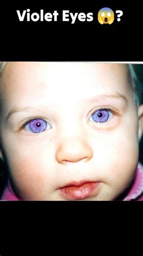 Violet Eyes?! 😱 Human Mystery