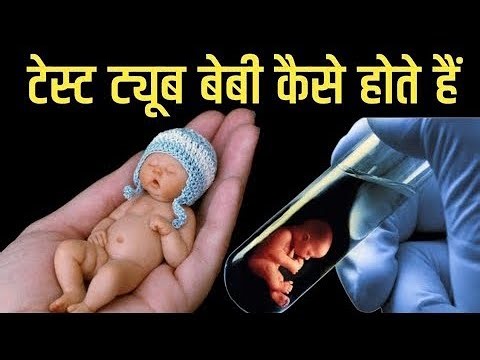 टेस्ट ट्यूब बेबी क्या होता है? टेस्ट ट्यूब से बच्चे का निर्माण कैसे होता है?