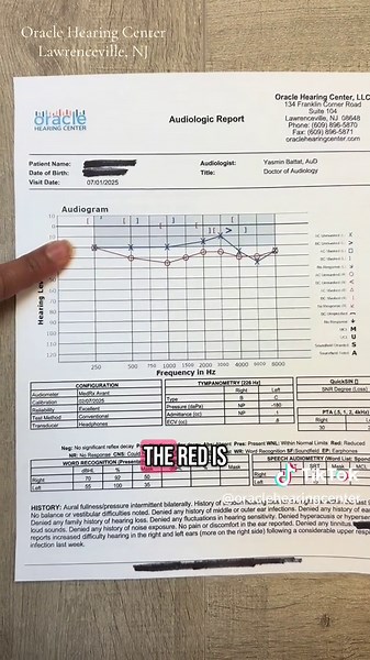 Understanding Middle Ear Effusion and Hearing Loss