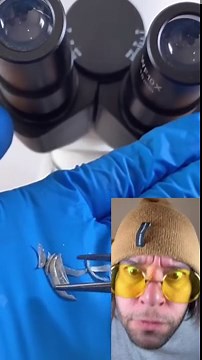 What's Living Under Fingernails? Microscope Debunked Edition!