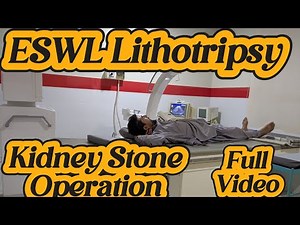 Watch a Real ESWL Lithotripsy Procedure | lithotripsy treatment | Laser Operation Kidney Stones