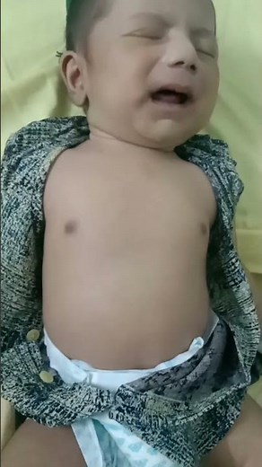 Sign of pneumonia //Fast breathing // Chest indrawing @medicalarena