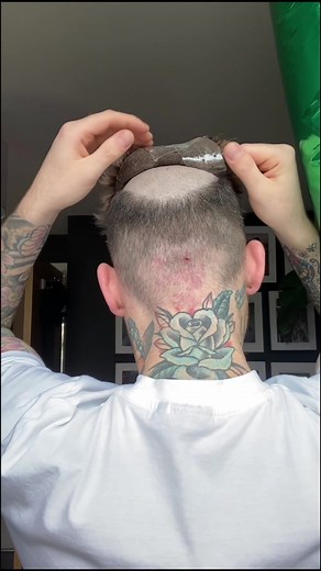 Say Goodbye to Hair Loss with Our Ultimate Hair Systems!