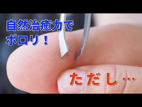An easy way to remove a thorn that has penetrated deep inside! If you leave it...