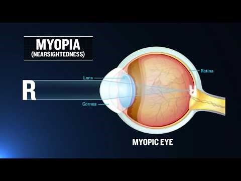 OpenStax AP Physics Chapter 25: Refraction (Physics Concept Trailer™)