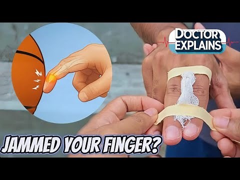 Fix Your Jammed Finger in 2 MINUTES – Doc & Baller Show Simple Steps