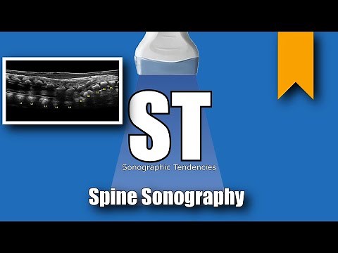 Neonatal/Infant Spine Sonography