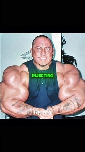 His Arm Exploded at the Gym 💉💥