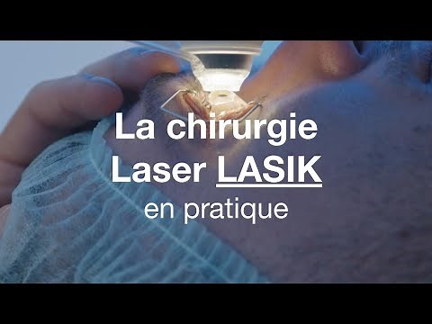 Chirurgie laser LASIK : comment ça se passe ? - COF